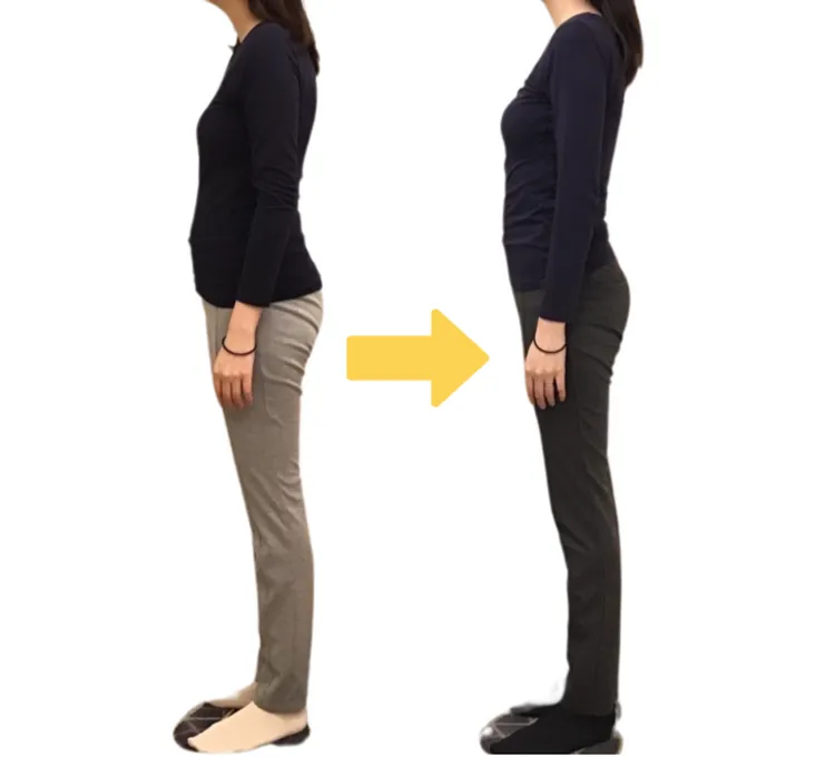 ビフォーアフター１