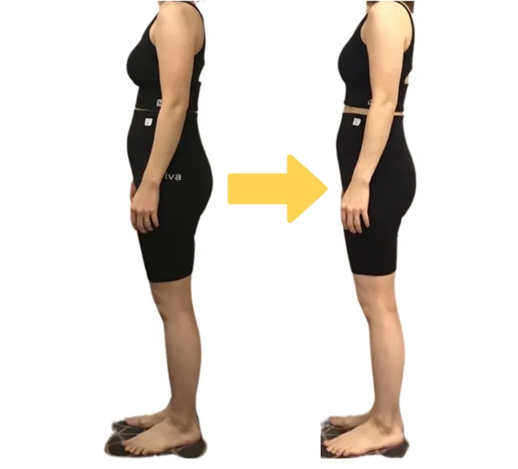 ビフォーアフター1