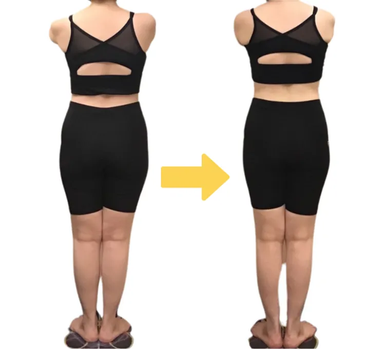 ビフォーアフター１