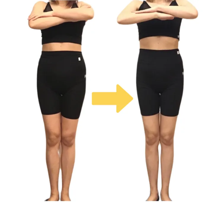 ビフォーアフター１