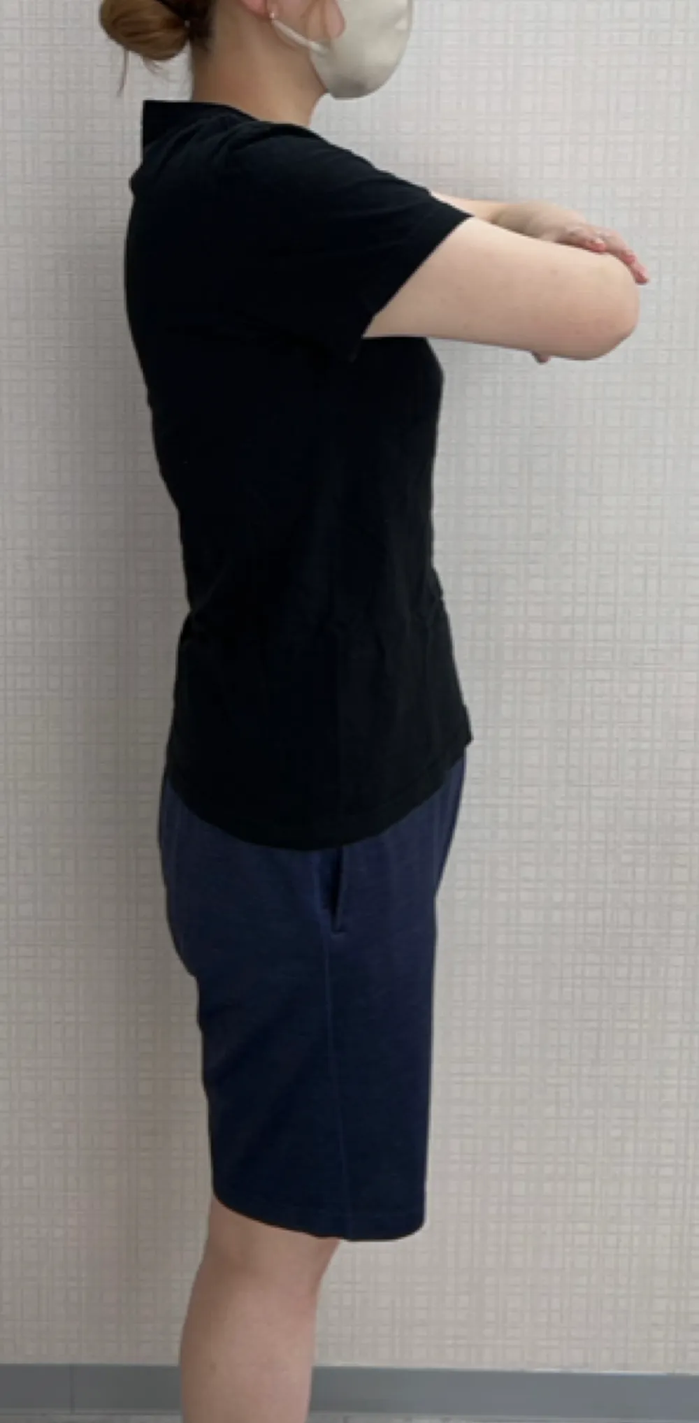 アフター